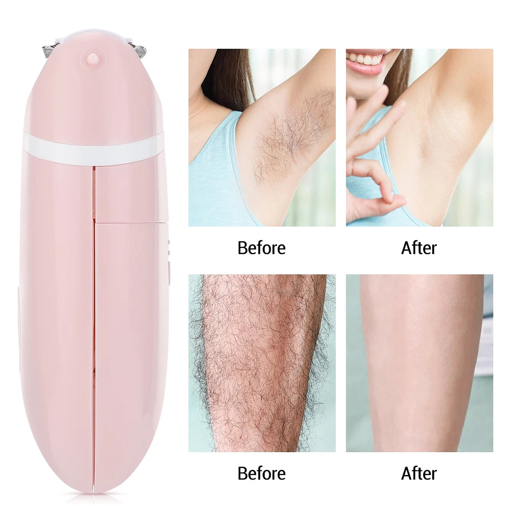 Portable Electric Hair Removal Epilator Women Permanent Painless Face Body Trimmer Bikini 30ml Salicylic Acid Acne Removal Cream